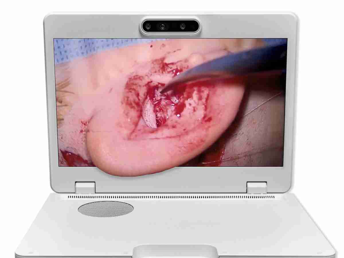 达擎之＂Heads-up 3D显微手术显示系统＂，，，，整合4K裸眼3D显示及眼球追踪系统，，，具备快速追踪人眼移动位置功能，，，，减轻医师长时间维持固定姿势的负担，，让医师能有更宽广清晰的3D立体视野及更舒适的姿势来执行手术。。。。